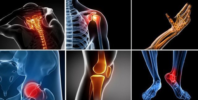 Diseases of vertebral column and Joints